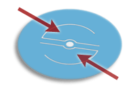 The Mildont&reg; in its normal closed position